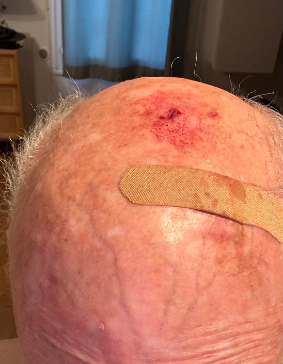 Red Badge of Courage